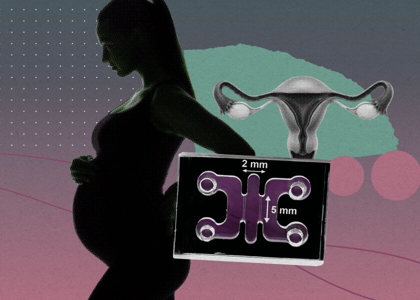 womborganoid.jpg